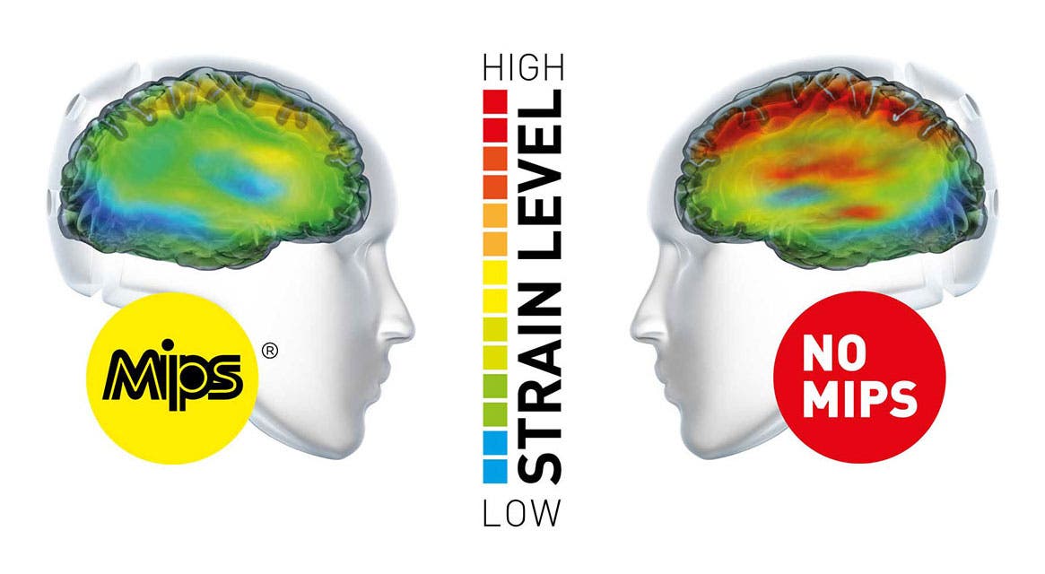 mips-brain-vs-nomips-brain-strain